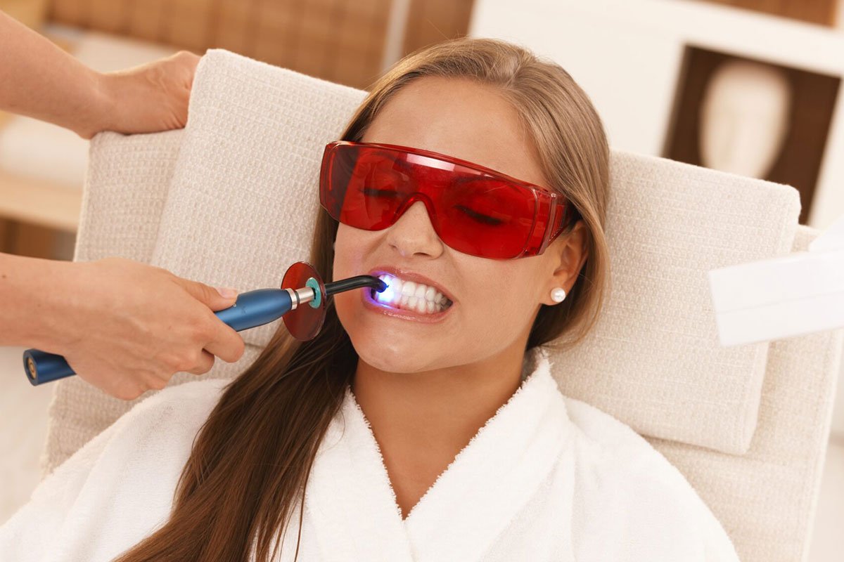 Teeth Whitening